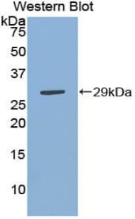 IKBIP Antibody (aa78-301, FITC)