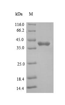 Brugia malayi JTB / PAR Protein (Recombinant 6His-SUMO, N-terminus)
