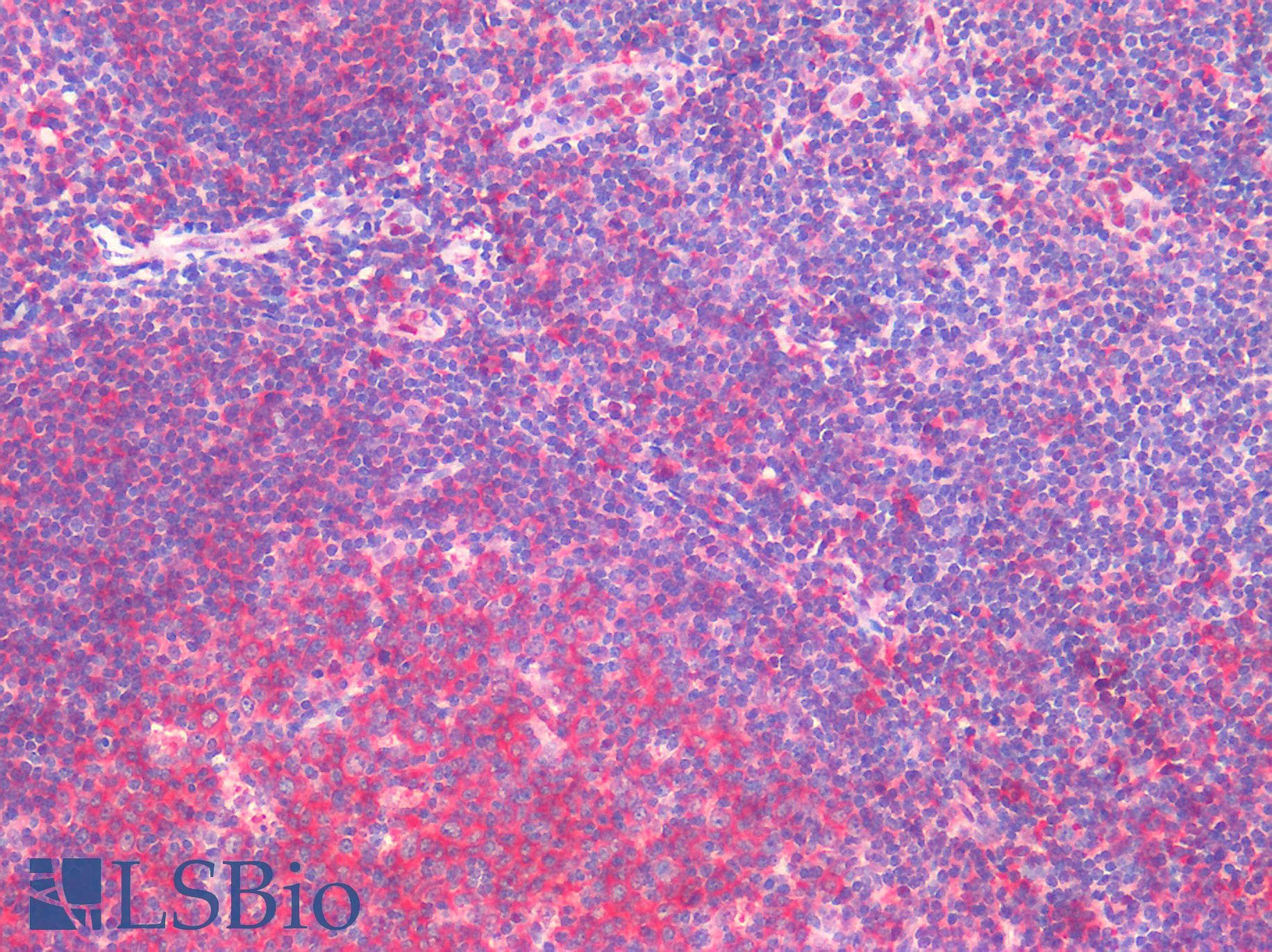 IHC-plus™ Polyclonal Rabbit anti-Human HTR2C / 5-HT2C Receptor Antibody (C-Terminus, IHC)