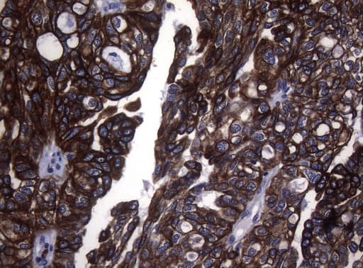Monoclonal Mouse anti-Human KRT18 / CK18 / Cytokeratin 18 Antibody (clone OTI5E4, aa69-372, IHC, WB)