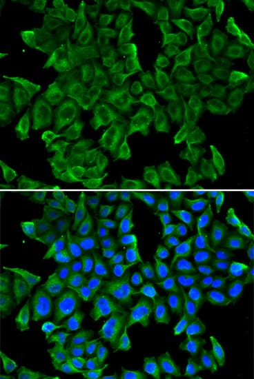 IHC-plus™ REG3G Antibody