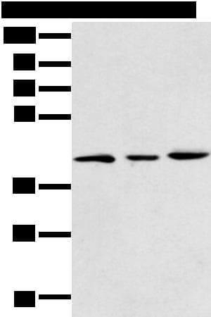 DCX / Doublecortin Antibody