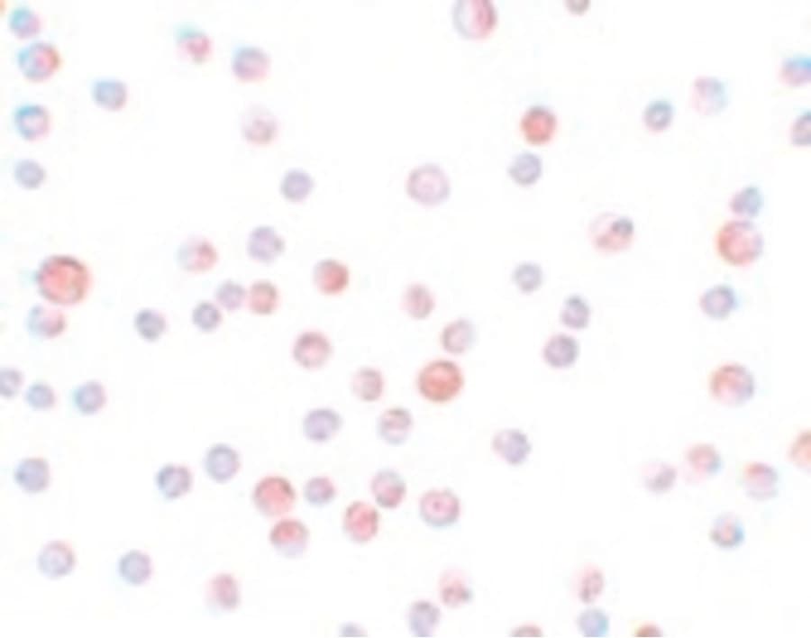 IHC-plus™ Polyclonal Rabbit anti-Human CABP7 Antibody (IHC, IF, WB)