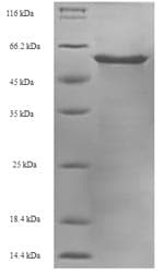 Cow HNRNPA2B1 Protein (Recombinant 6His-SUMO, N-terminus)