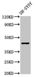 OPRM1 / Mu Opioid Receptor Antibody