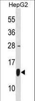 IHC-plus™ Polyclonal Rabbit anti-Human HSPE1 / HSP10 / Chaperonin 10 Antibody (aa38-64, IHC, WB)