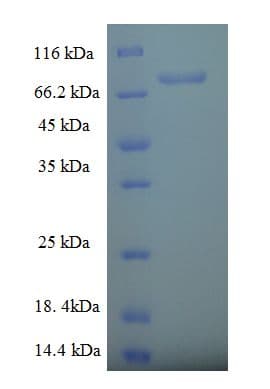 Human RABGEF1 Protein (Recombinant His-SUMO)