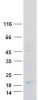 Human CCL21 / SLC Protein (Recombinant Myc-DDK (Flag))