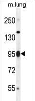Polyclonal Rabbit anti-Mouse PARP9 Antibody (aa599-629, WB)