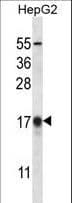 MAP1LC3B / LC3B Antibody (aa9-33)