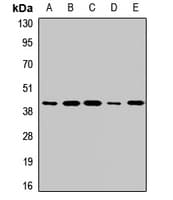 IHC-plus™ RAMP3 Antibody
