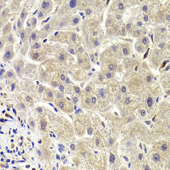 AKT1S1 / PRAS40 Antibody
