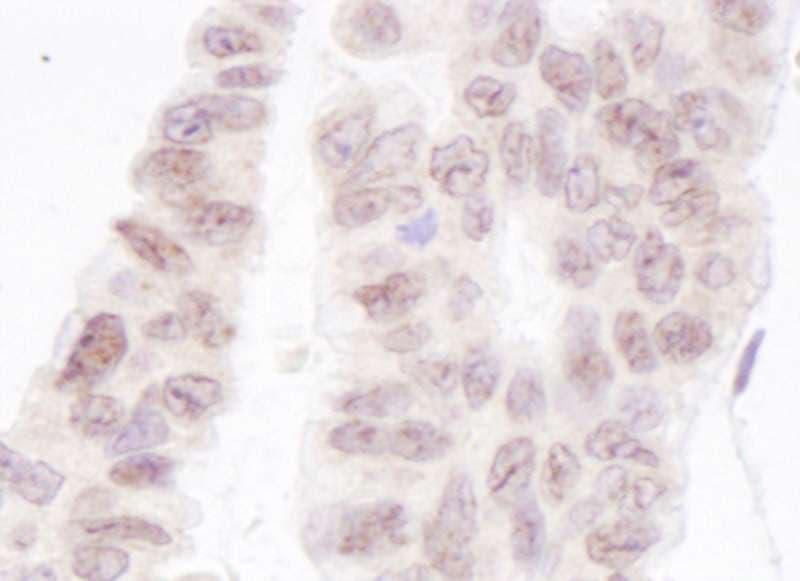 PNKP Antibody (aa100-150)