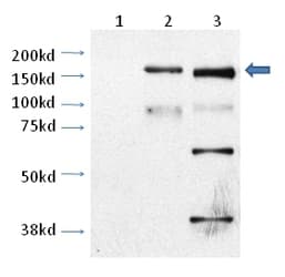 TRPM2 Antibody (C-Terminus, Biotin)