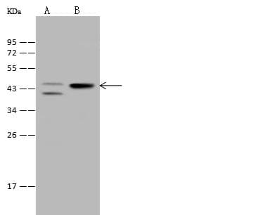 PRKACA Antibody (Preservative Free)