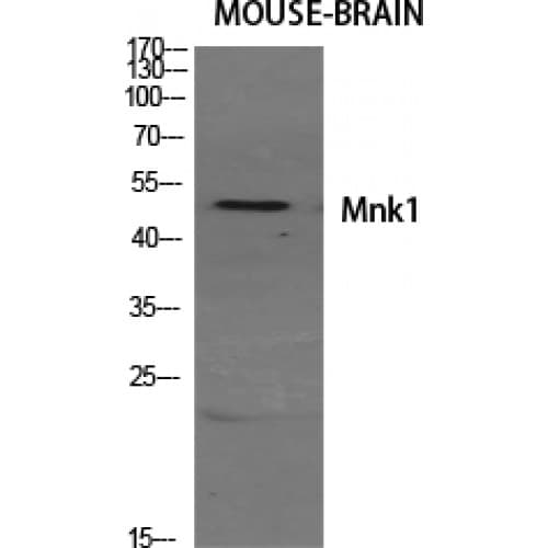 Polyclonal Rabbit anti-Human MKNK1 / MNK1 Antibody (80-160 aa, Internal, IHC, WB)