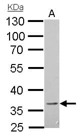 BTLA / CD272 Antibody (aa1-164)