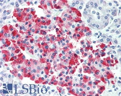 IHC-plus™ Polyclonal Rabbit anti-Human PDE3B Antibody (aa500-550, IHC, WB)