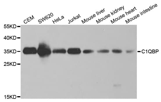 GC1qR / C1QBP Antibody