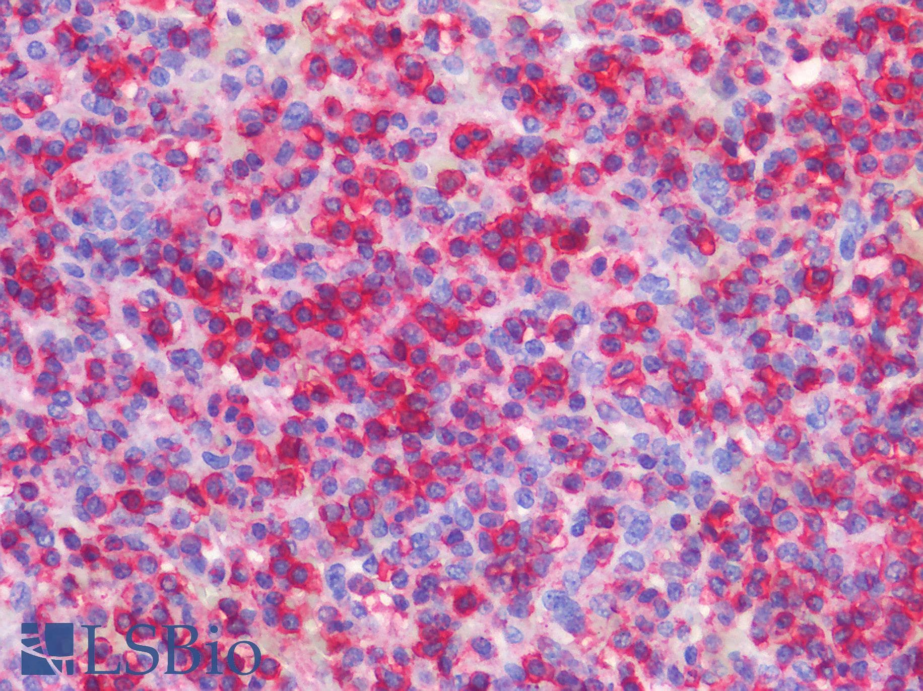 IHC-plus™ Polyclonal Rabbit anti-Human CD45 / LCA Antibody (IHC)