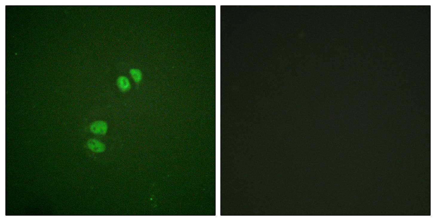 PLK1 / PLK-1 Antibody (p210)