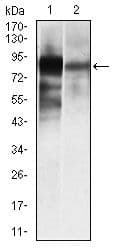 Monoclonal Mouse anti-Human ALPL / Alkaline Phosphatase Antibody (clone 2F4, IHC, WB)