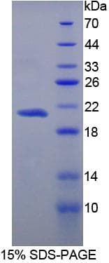 Human CPN1 Protein (Recombinant 6His, N-terminus)