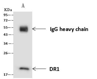 DR1 / NC2 Antibody