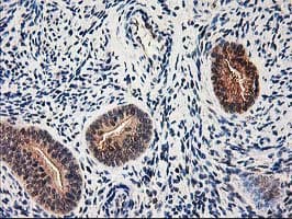 ALS2CR1 / NIF3L1 Antibody (clone OTI3E1)