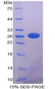 Mouse MPP2 Protein (Recombinant His-T7)