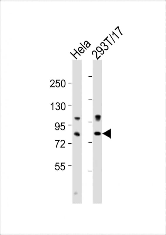 IHC-plus™ RPS6KA4 / MSK2 / RSK-B Antibody (aa692-725)