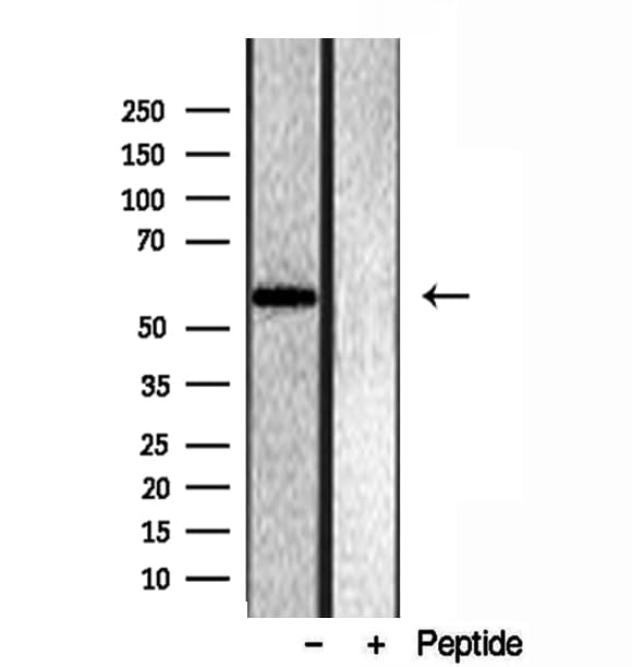 OXCT1 Antibody