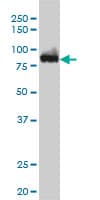 IHC-plus™ Monoclonal Mouse anti-Human CSE1L Antibody (clone 3F8, IHC, IF, WB)