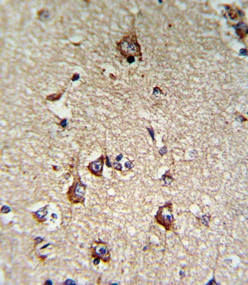 CD71 / Transferrin Receptor Antibody (aa649-677)