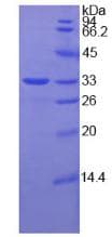 Human SEPP1 / Selenoprotein P (Recombinant His)