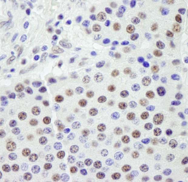 Polyclonal Rabbit anti-Human SF3A1 / SF3A120 Antibody (aa300-350, IHC, IF)