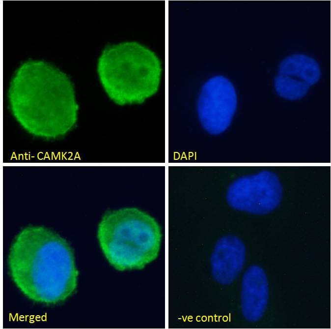 PathPlus™ CAMK2A / CaMKII Alpha Antibody (aa455-468)