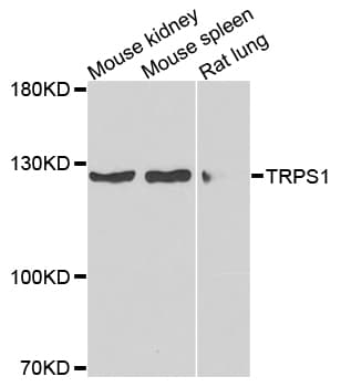 Polyclonal Rabbit anti-Human TRPS1 Antibody (IF, WB)
