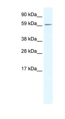 ARA55 / HIC-5 Antibody (aa179-228)