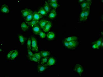 Polyclonal Rabbit anti-Human Osteoglycin / Mimecan Antibody (aa21-298)