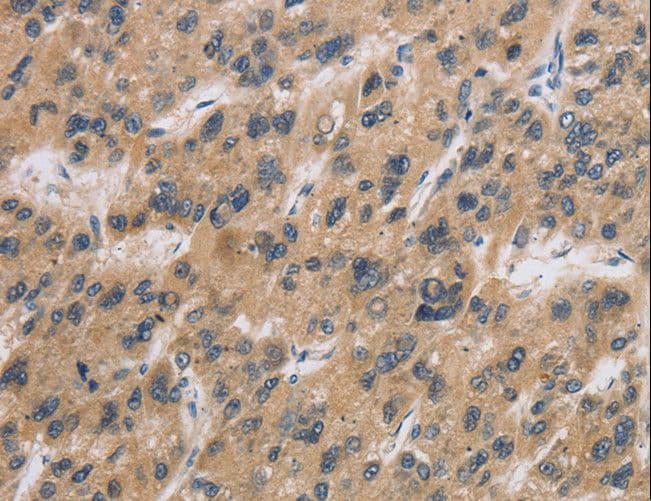 CST6 / Cystatin E/M Antibody