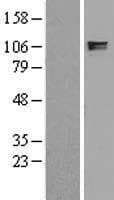 ITIH2 Protein (Over-Expression Lysate Myc-DDK (Flag))