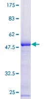 Human RPL10 / Ribosomal Protein L10 (Recombinant GST)