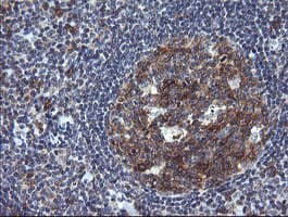 CD45 / LCA Antibody (clone OTI2H1)