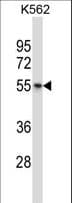 Polyclonal Rabbit anti-Human AVPR1B Antibody (aa289-317, WB)