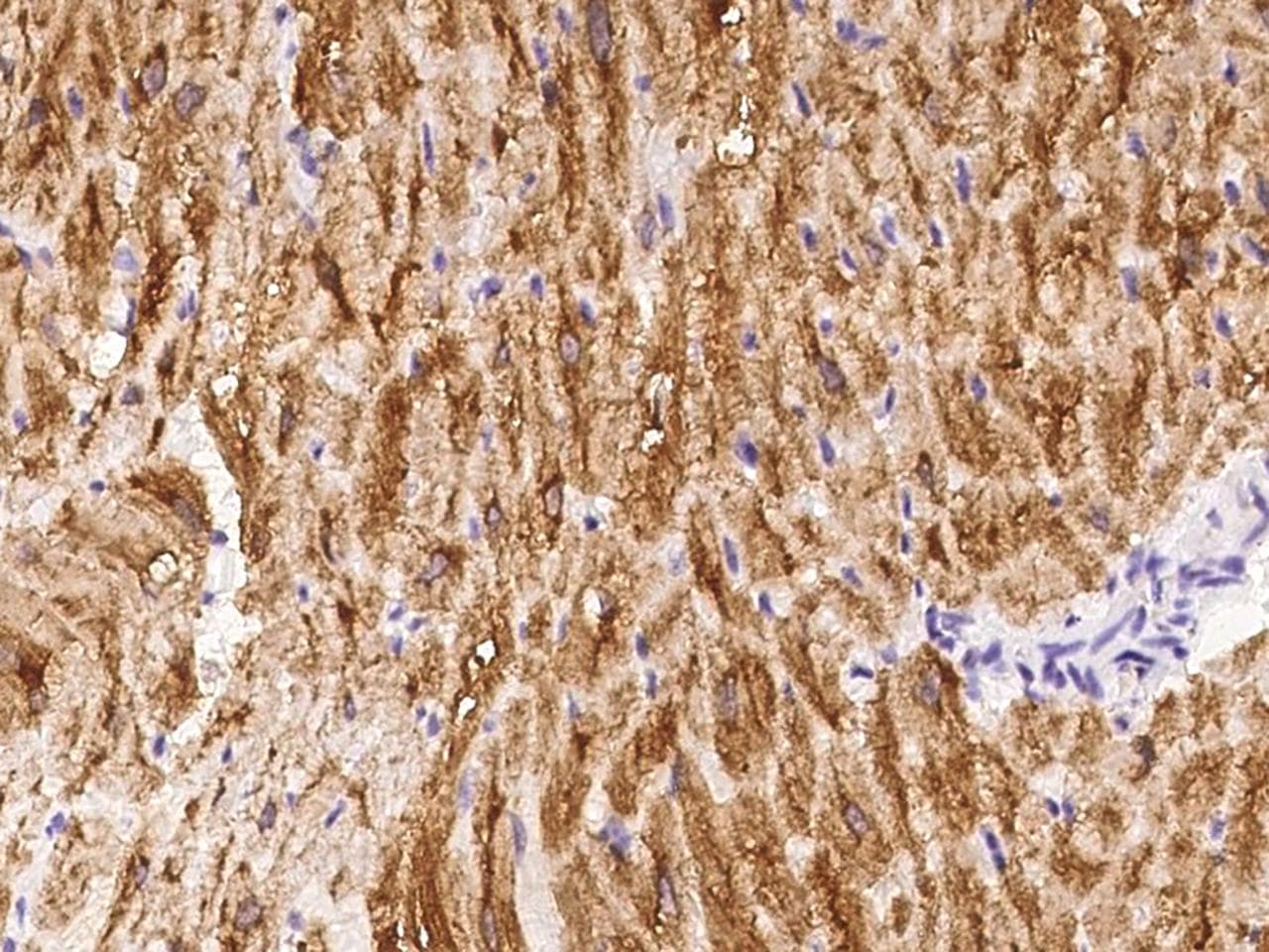 Polyclonal Rabbit anti-Human CKM / Creatine Kinase MM Antibody (IHC)