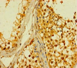 PLD6 / Phospholipase D6 Antibody