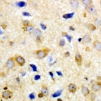 NPY5R Antibody (Internal)