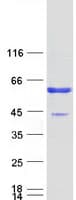 Human CA14 / Carbonic Anhydrase XIV Protein (Recombinant Myc-DDK (Flag))