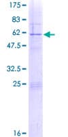 Human RPS4Y1 Protein (Recombinant GST)